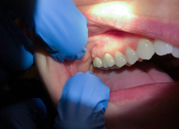 Best Emergency Tooth Extraction  in Suitland, MD