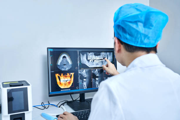 Teeth Whitening in MD