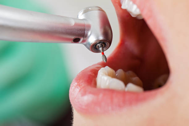 Best Dentist Open on Weekends  in Suitland, MD